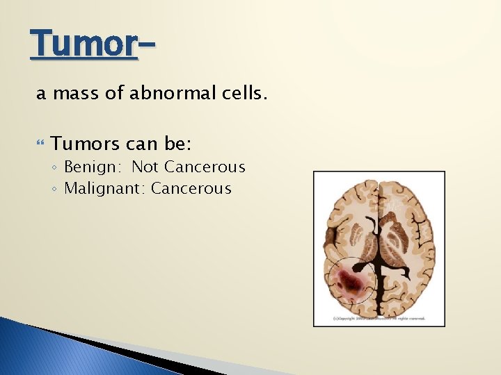 Tumora mass of abnormal cells. Tumors can be: ◦ Benign: Not Cancerous ◦ Malignant: