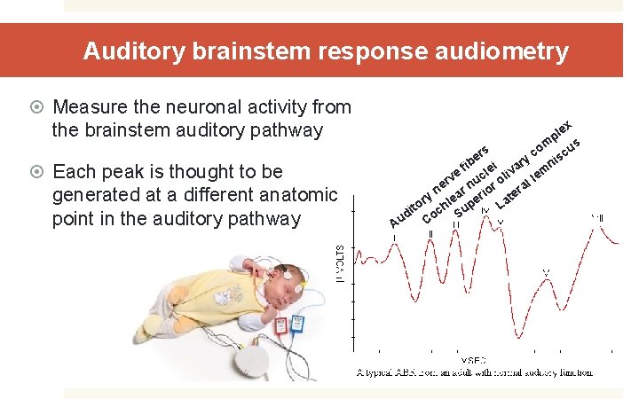 Auditory brainstem response audiometry Measure the neuronal activity from the brainstem auditory pathway Each