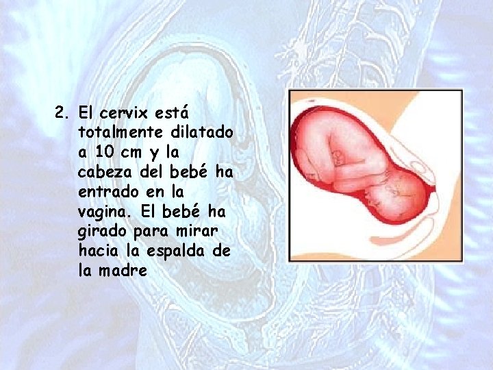 2. El cervix está totalmente dilatado a 10 cm y la cabeza del bebé