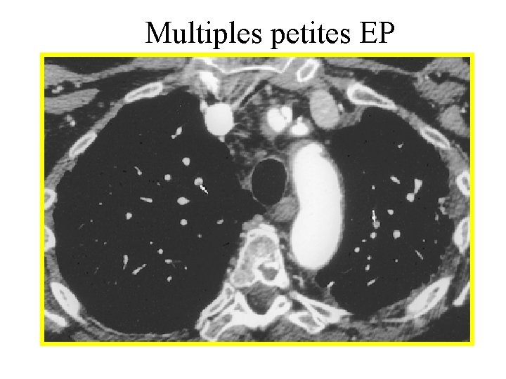 Multiples petites EP 