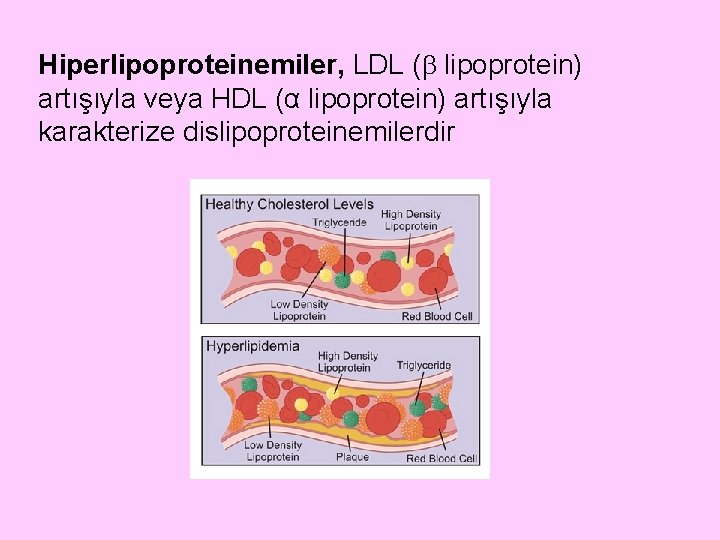 Hiperlipoproteinemiler, LDL ( lipoprotein) artışıyla veya HDL (α lipoprotein) artışıyla karakterize dislipoproteinemilerdir 