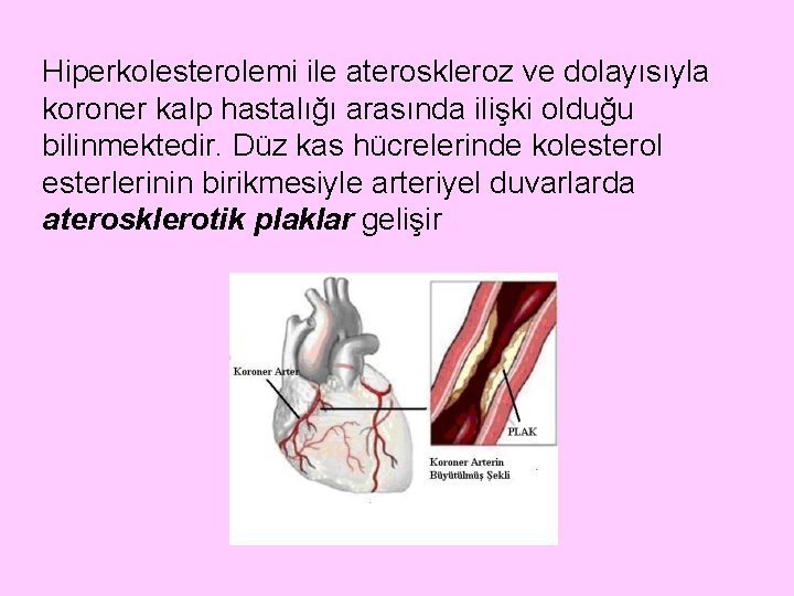 Hiperkolesterolemi ile ateroskleroz ve dolayısıyla koroner kalp hastalığı arasında ilişki olduğu bilinmektedir. Düz kas