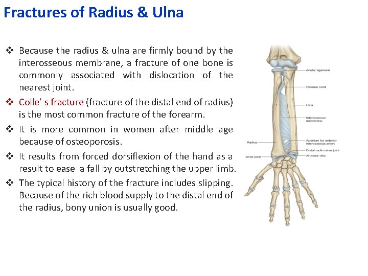 Fractures of Radius & Ulna v Because the radius & ulna are firmly bound