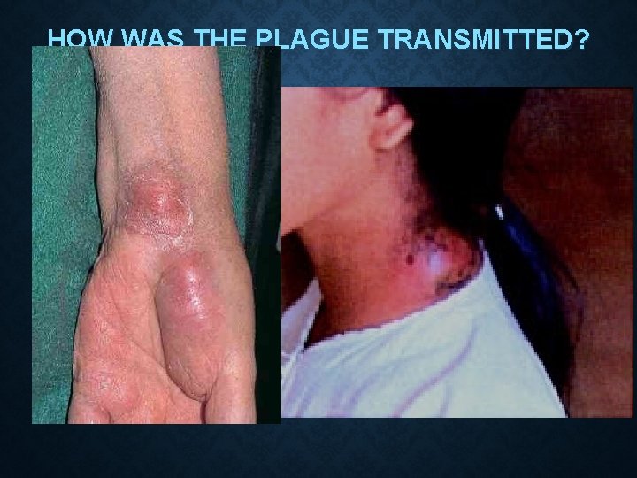 HOW WAS THE PLAGUE TRANSMITTED? We now know that the most common form of