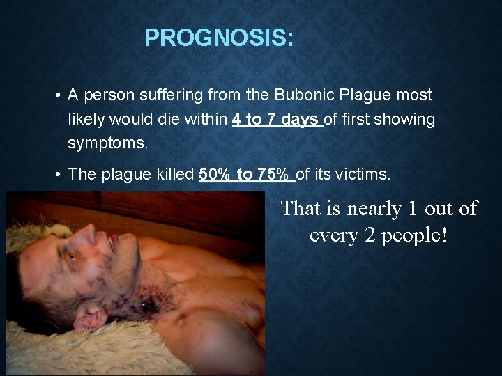 PROGNOSIS: • A person suffering from the Bubonic Plague most likely would die within