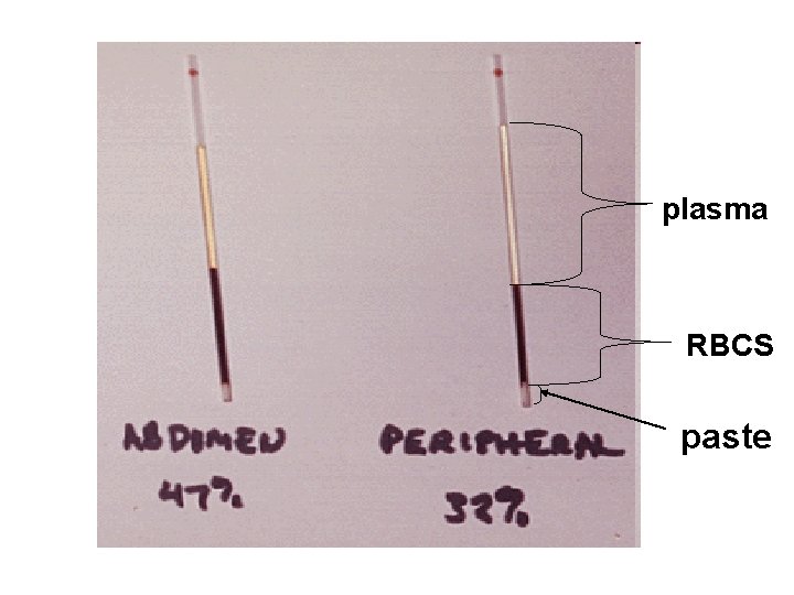 plasma RBCS paste 