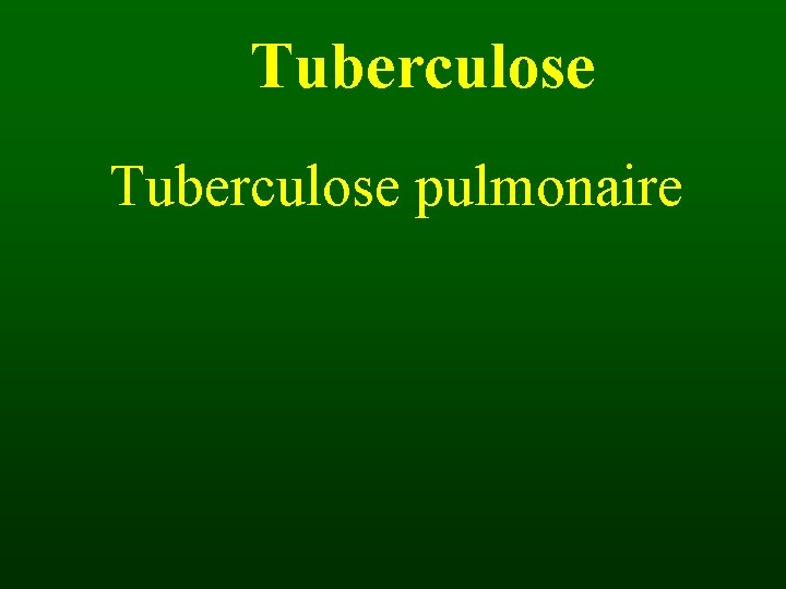 Tuberculose pulmonaire 