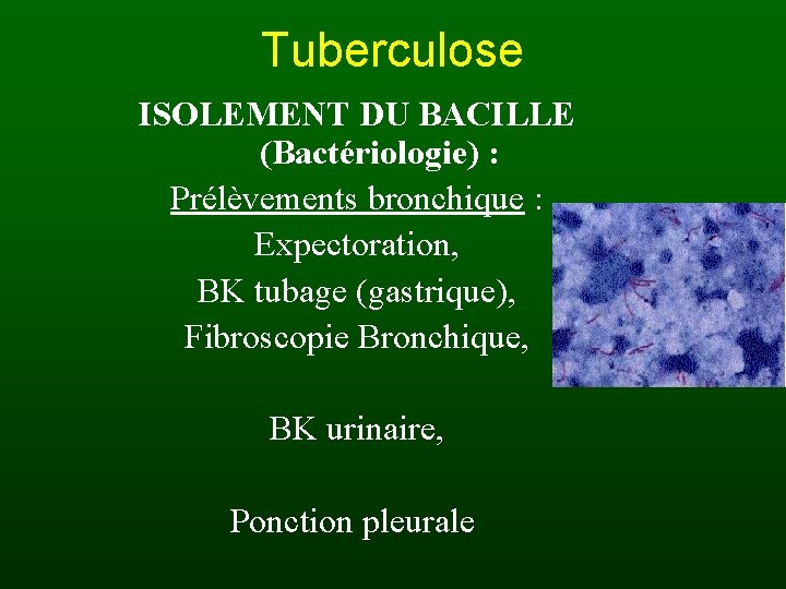 Tuberculose ISOLEMENT DU BACILLE (Bactériologie) : Prélèvements bronchique : Expectoration, BK tubage (gastrique), Fibroscopie