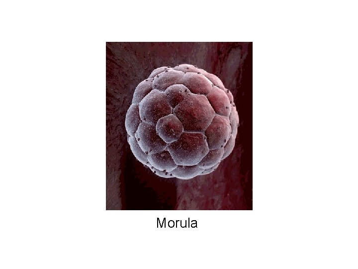 Morula 