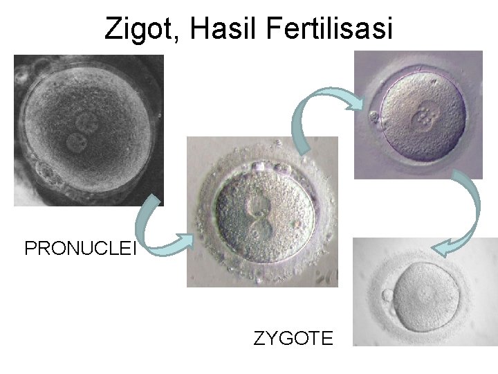 Zigot, Hasil Fertilisasi PRONUCLEI ZYGOTE 