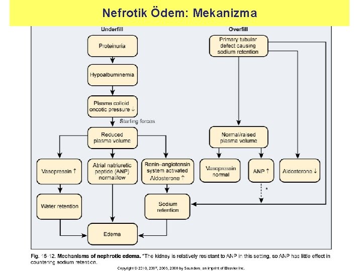 Nefrotik Ödem: Mekanizma 