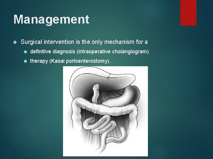 Management Surgical intervention is the only mechanism for a definitive diagnosis (intraoperative cholangiogram) therapy