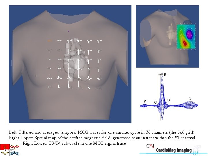 Left: Filtered and averaged temporal MCG traces for one cardiac cycle in 36 channels
