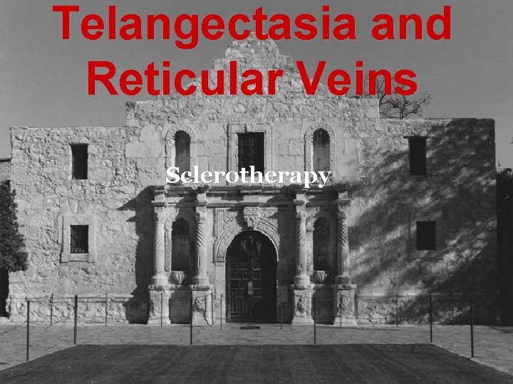 Telangectasia and Reticular Veins Sclerotherapy 