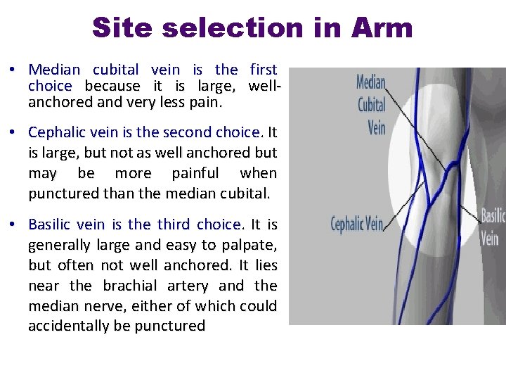 Site selection in Arm • Median cubital vein is the first choice because it