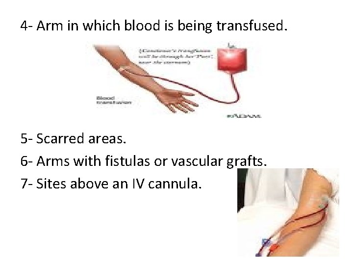 4 - Arm in which blood is being transfused. 5 - Scarred areas. 6