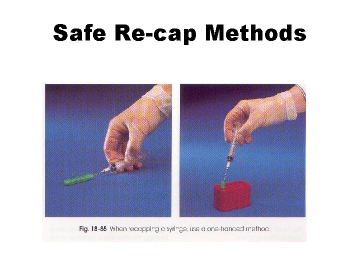 Safe Re-cap Methods 