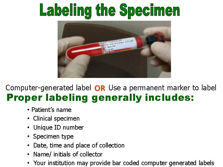 Labeling the Specimen Computer-generated label OR Use a permanent marker to label Proper labeling
