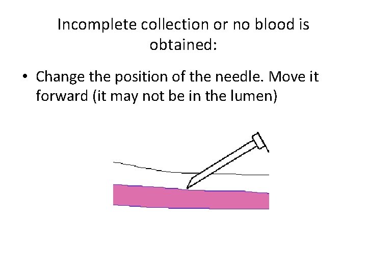 Incomplete collection or no blood is obtained: • Change the position of the needle.