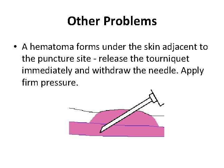 Other Problems • A hematoma forms under the skin adjacent to the puncture site