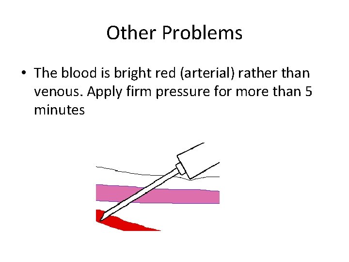 Other Problems • The blood is bright red (arterial) rather than venous. Apply firm