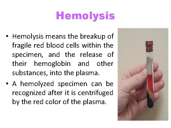 Hemolysis • Hemolysis means the breakup of fragile red blood cells within the specimen,