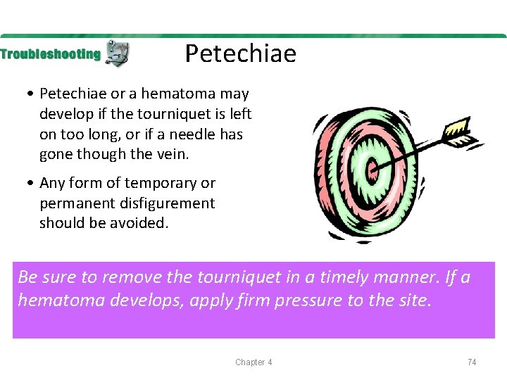Petechiae • Petechiae or a hematoma may develop if the tourniquet is left on
