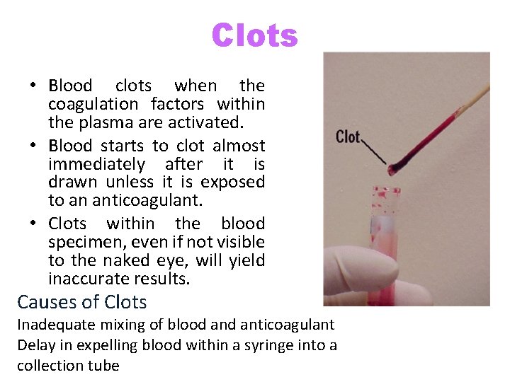 Clots • Blood clots when the coagulation factors within the plasma are activated. •