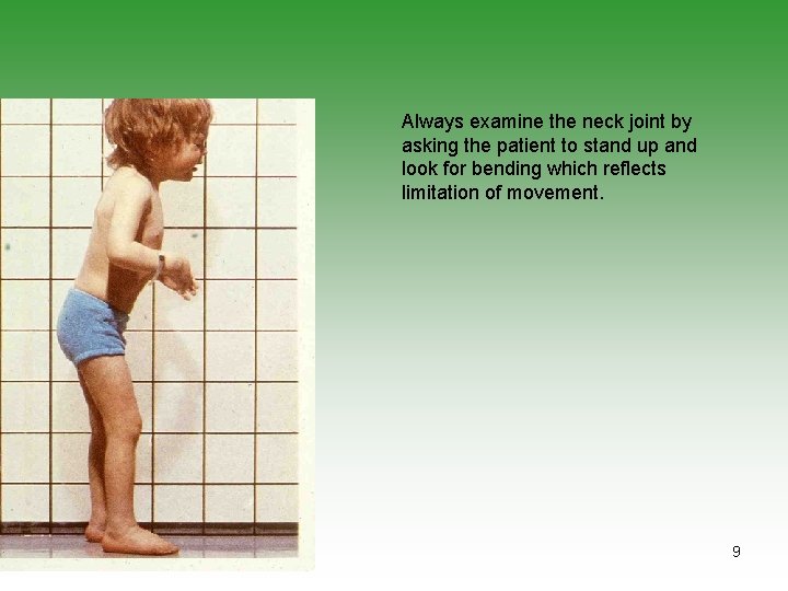 Always examine the neck joint by asking the patient to stand up and look