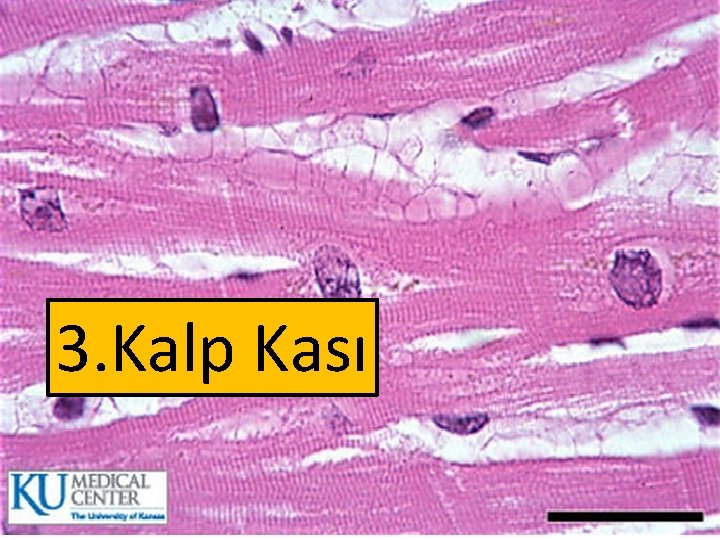 3. Kalp Kası 3. Kalp Kası