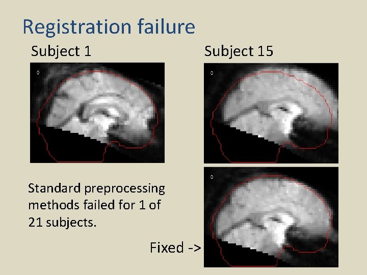 Registration failure Subject 15 Standard preprocessing methods failed for 1 of 21 subjects. Fixed