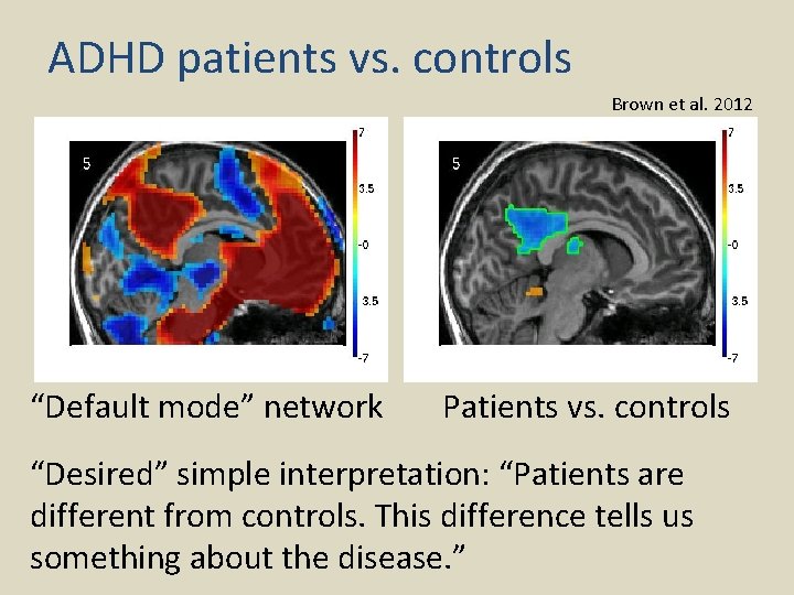 ADHD patients vs. controls Brown et al. 2012 “Default mode” network Patients vs. controls