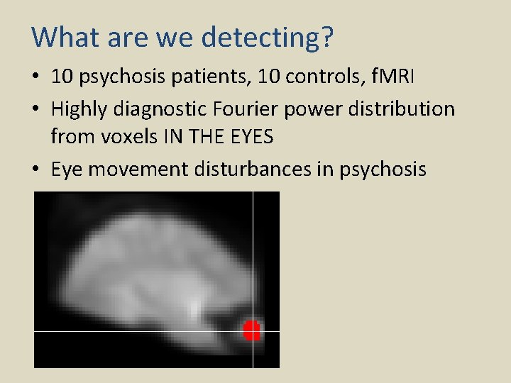What are we detecting? • 10 psychosis patients, 10 controls, f. MRI • Highly
