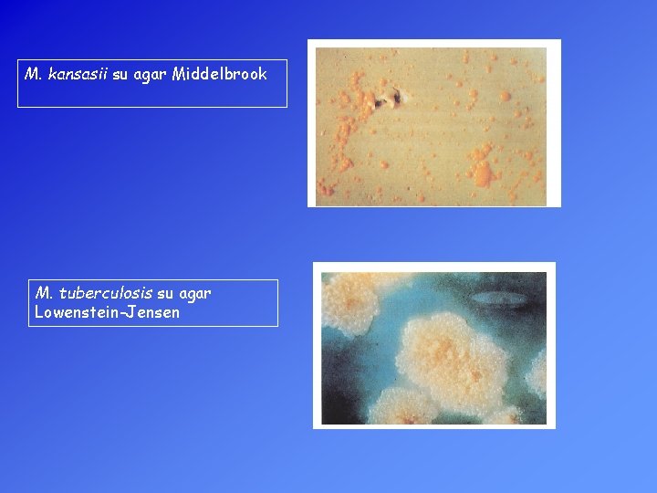 M. kansasii su agar Middelbrook M. tuberculosis su agar Lowenstein-Jensen 