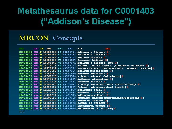 Metathesaurus data for C 0001403 (“Addison’s Disease”) 34 