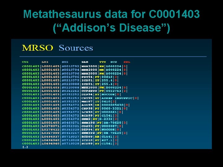 Metathesaurus data for C 0001403 (“Addison’s Disease”) 36 