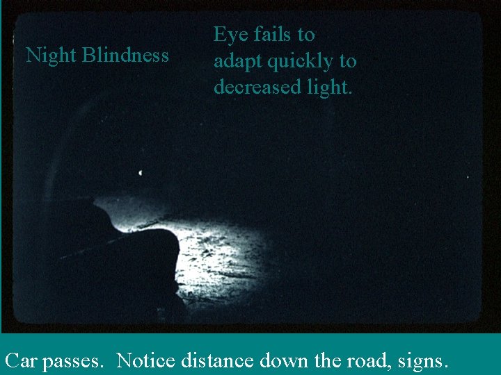Night Blindness Eye fails to adapt quickly to decreased light. Car passes. Notice distance