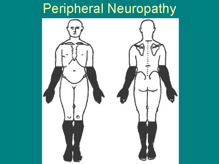 Peripheral Neuropathy 