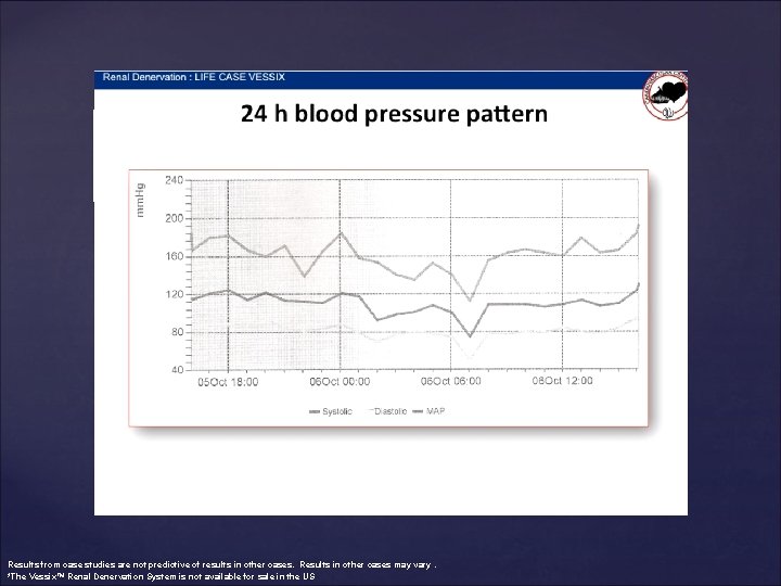 Results from case studies are not predictive of results in other cases. Results in