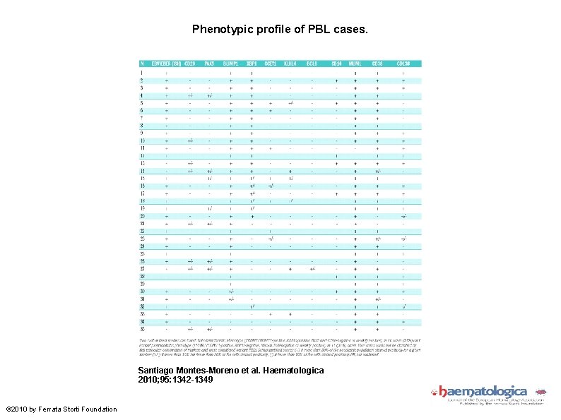 Phenotypic profile of PBL cases. Santiago Montes-Moreno et al. Haematologica 2010; 95: 1342 -1349