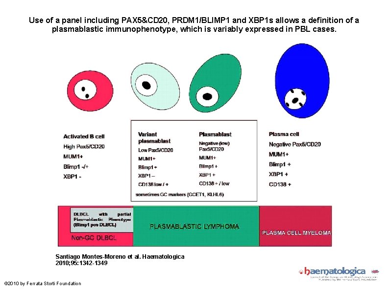 Use of a panel including PAX 5&CD 20, PRDM 1/BLIMP 1 and XBP 1
