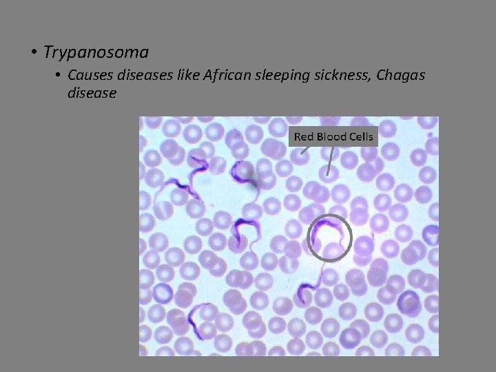  • Trypanosoma • Causes diseases like African sleeping sickness, Chagas disease 