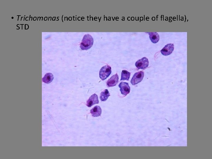  • Trichomonas (notice they have a couple of flagella), STD 