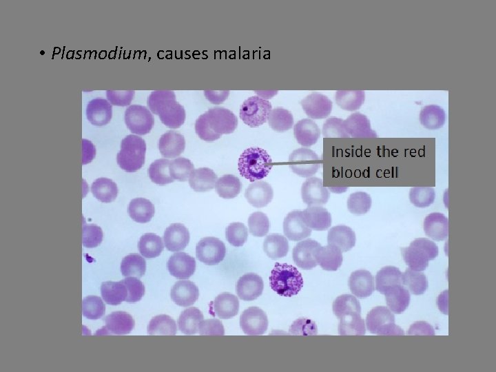  • Plasmodium, causes malaria 