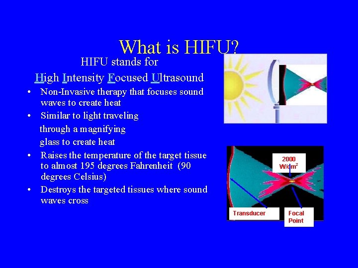 What is HIFU? HIFU stands for High Intensity Focused Ultrasound • Non-Invasive therapy that