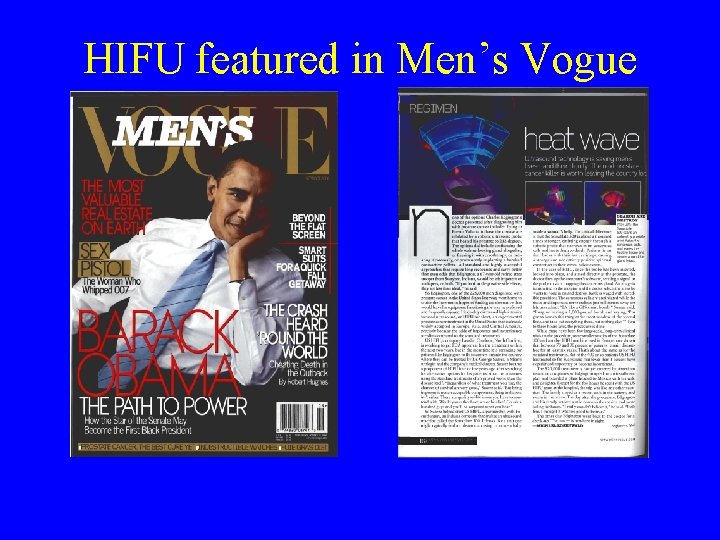 HIFU featured in Men’s Vogue 