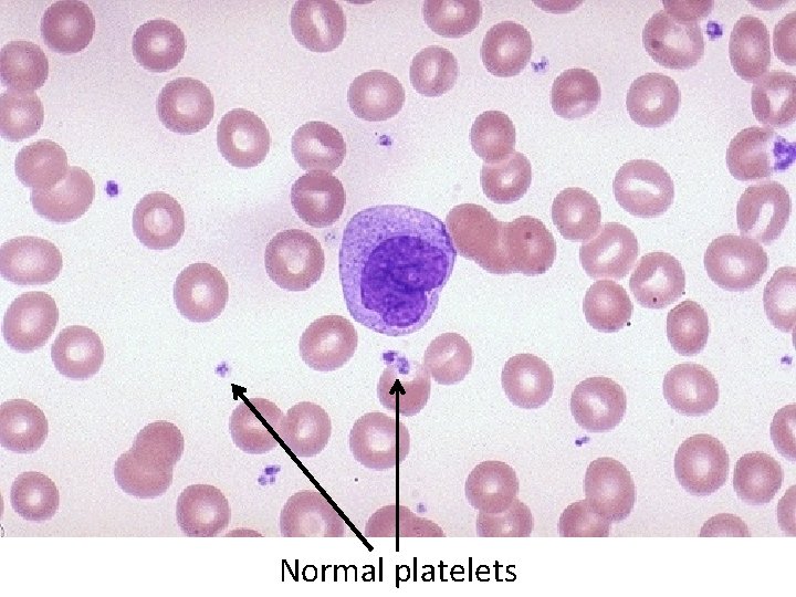 Normal platelets 