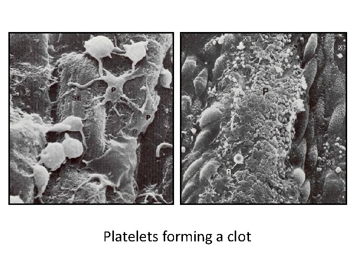 Platelets forming a clot 