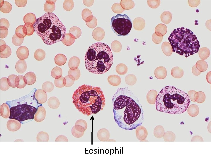 Eosinophil 