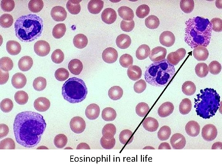 Eosinophil in real life 